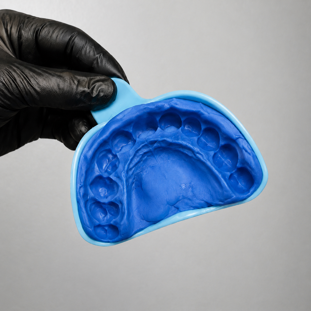 Grillz Impression Appointment at Impressive Glow in Kansas City, KS, KS