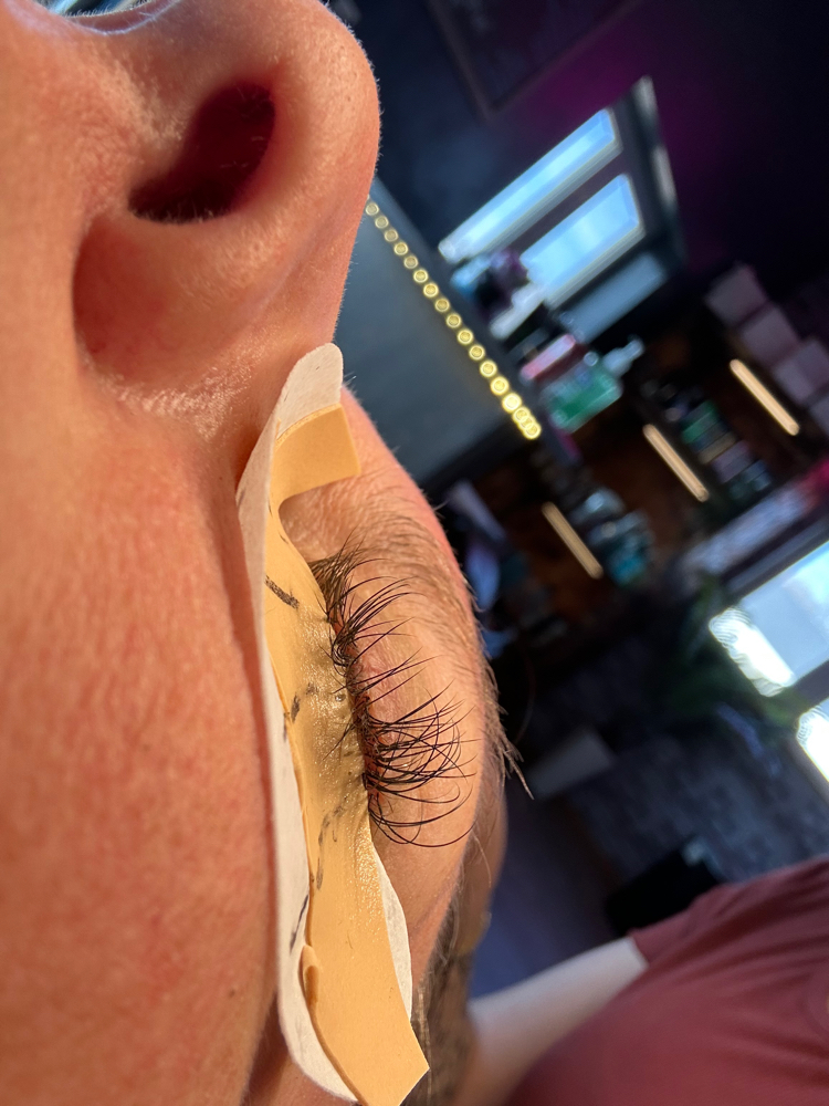 eyelash removal