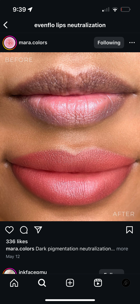 Neutralizacion de Labios obscuros