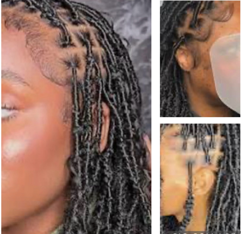 Soft Locs