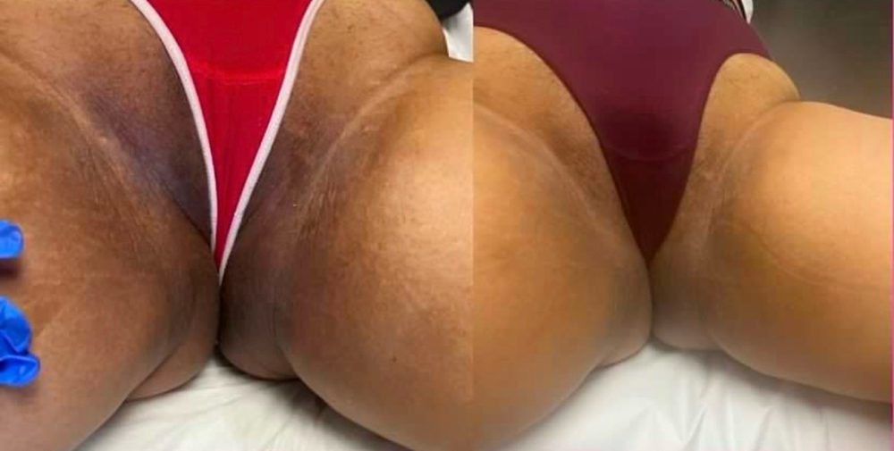 Intimate Skin Lightning Per Area at EmpowerHer Beauty in Zillah, WA