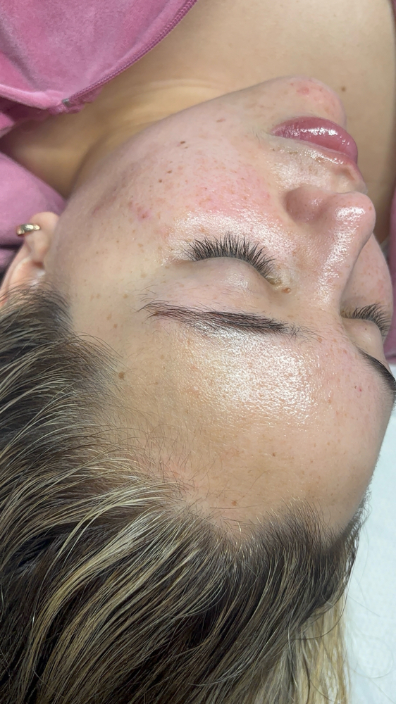 🪩 ✨Event Facial✨👰🏻♀️✈️