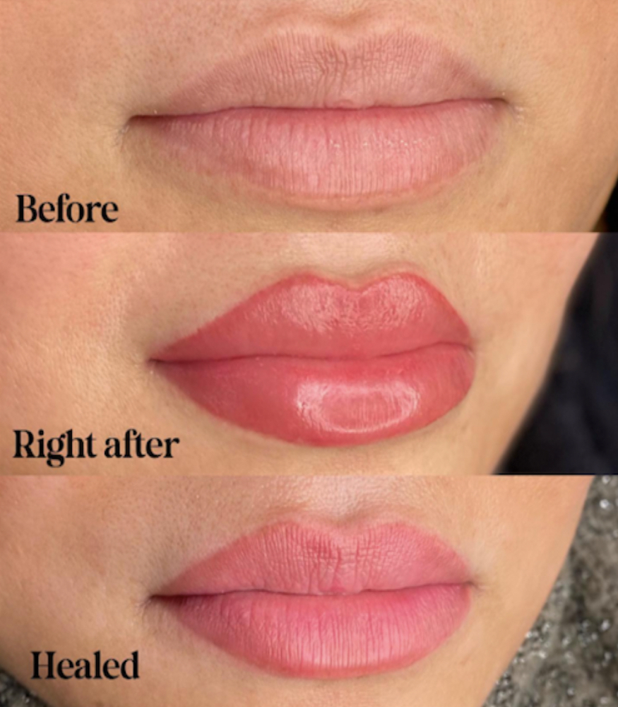 Lip Blushíng at Beat-iFul Aesthetics in Hollywood, FL