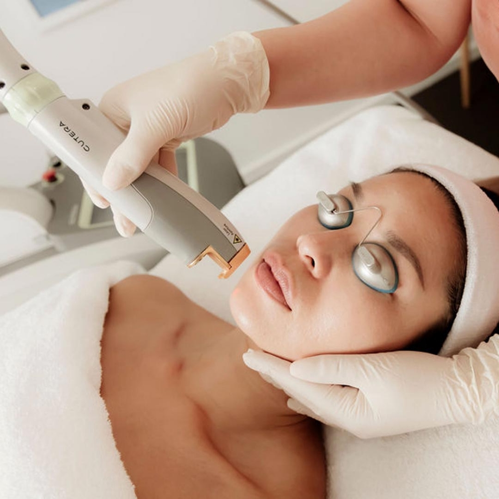 Laser Hair Removal (Chin)