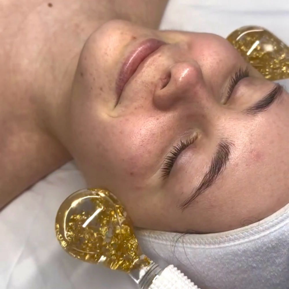 Ice Globes at Pearly Derm in Sun valley, CA
