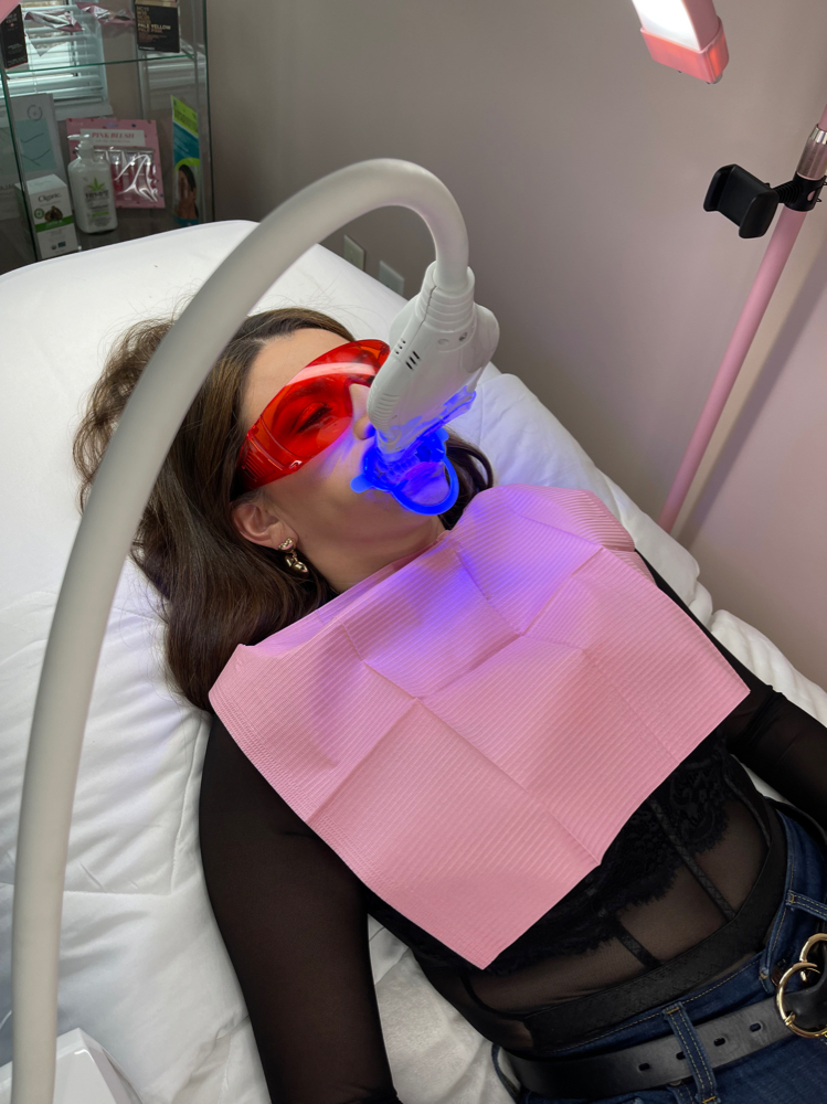 Cosmetic Teeth Whitening (90mins)