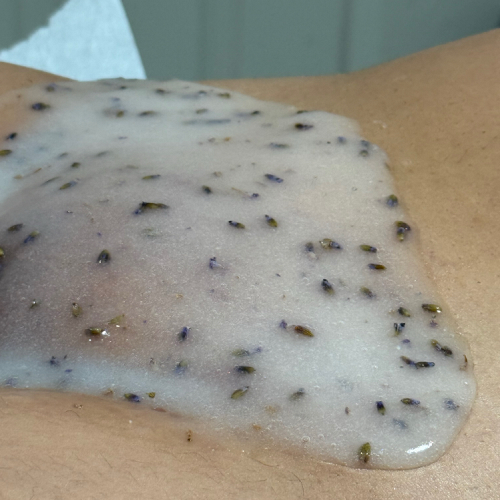 Post-wax Vajacial at The Epilation Lab in New Britain, CT