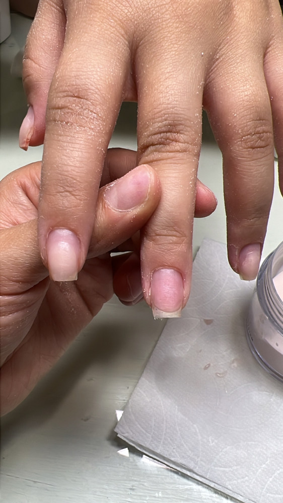 Acrylic Overlay