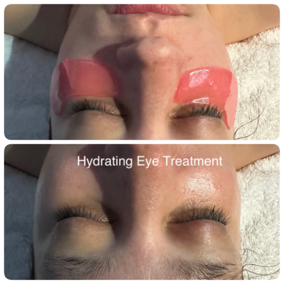 Rezenerate  Eye & Lip + on