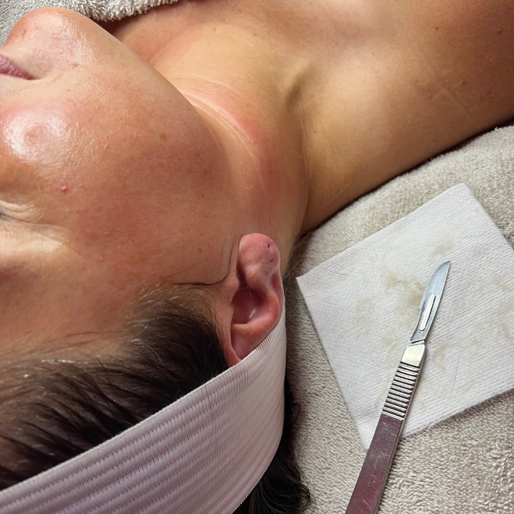 Dermaplaning Add-On