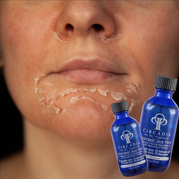 MandeliClear Peel System