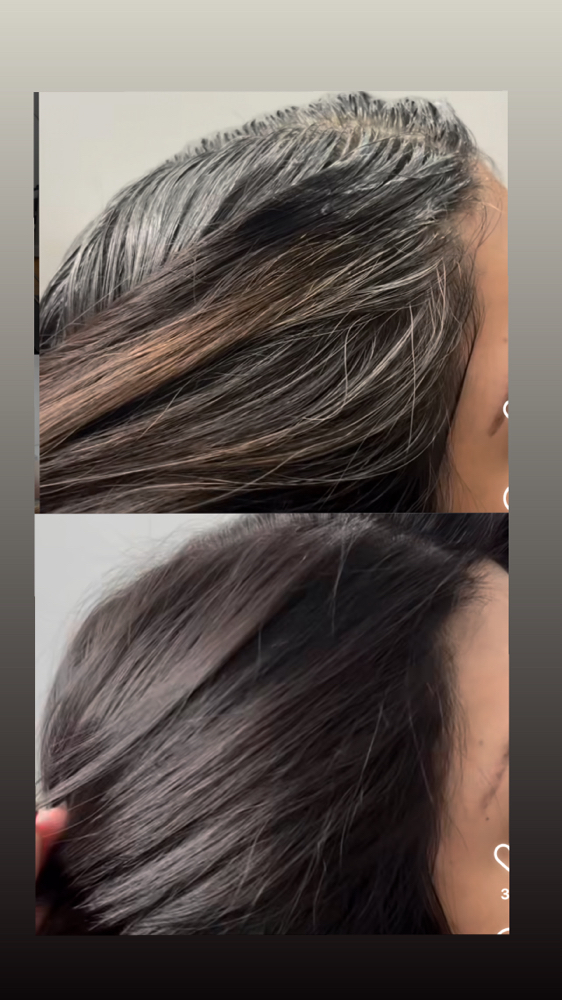 Root Retouch