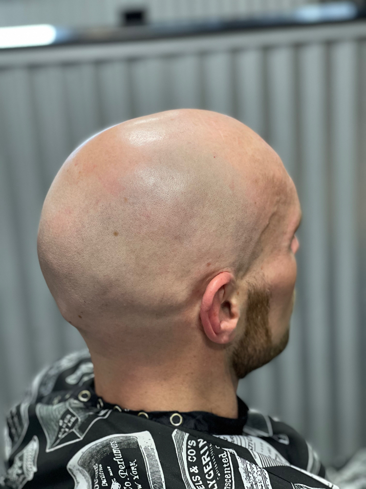 Hot Lather Head Shave