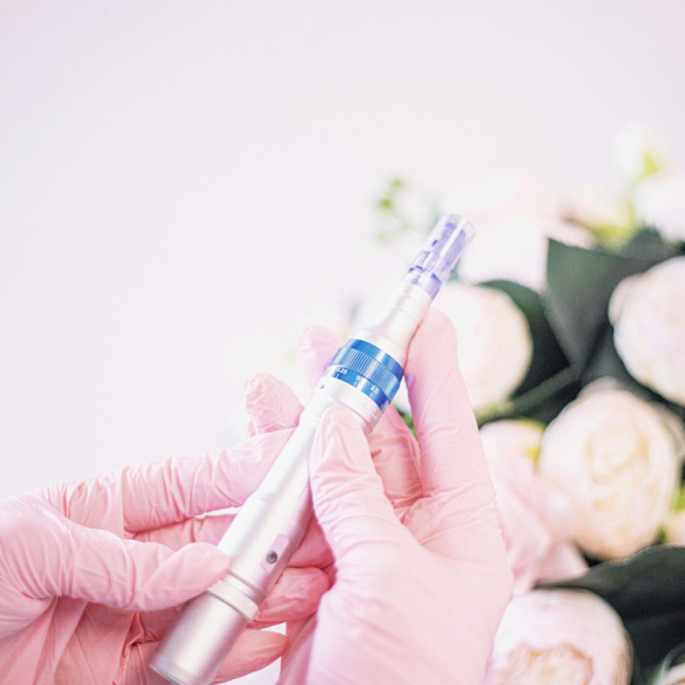 Microneedling at Flow and Glow RN in Corona, CA