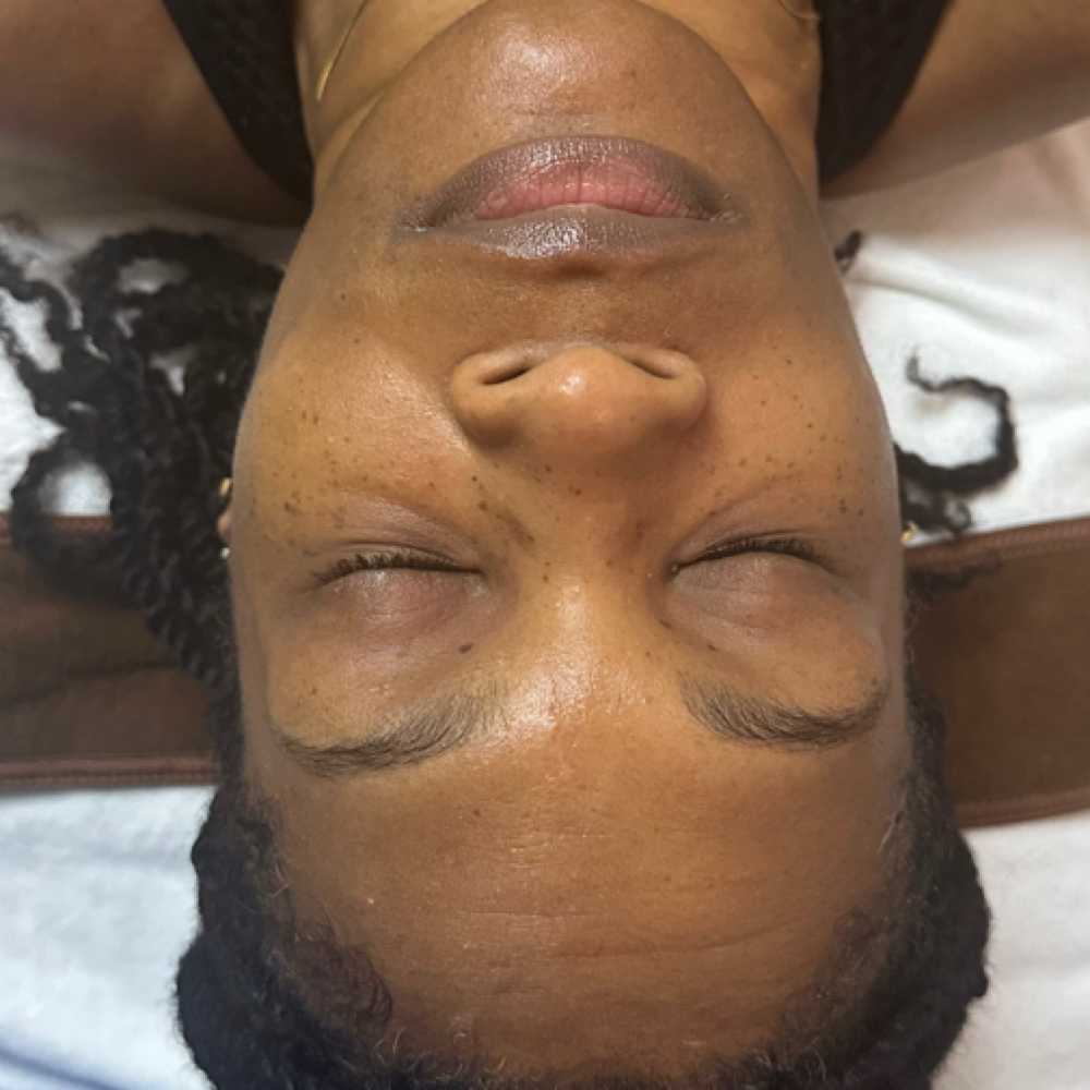 Chemical Peel Renewal at Noor Luxe Esthetics in Concord, NC