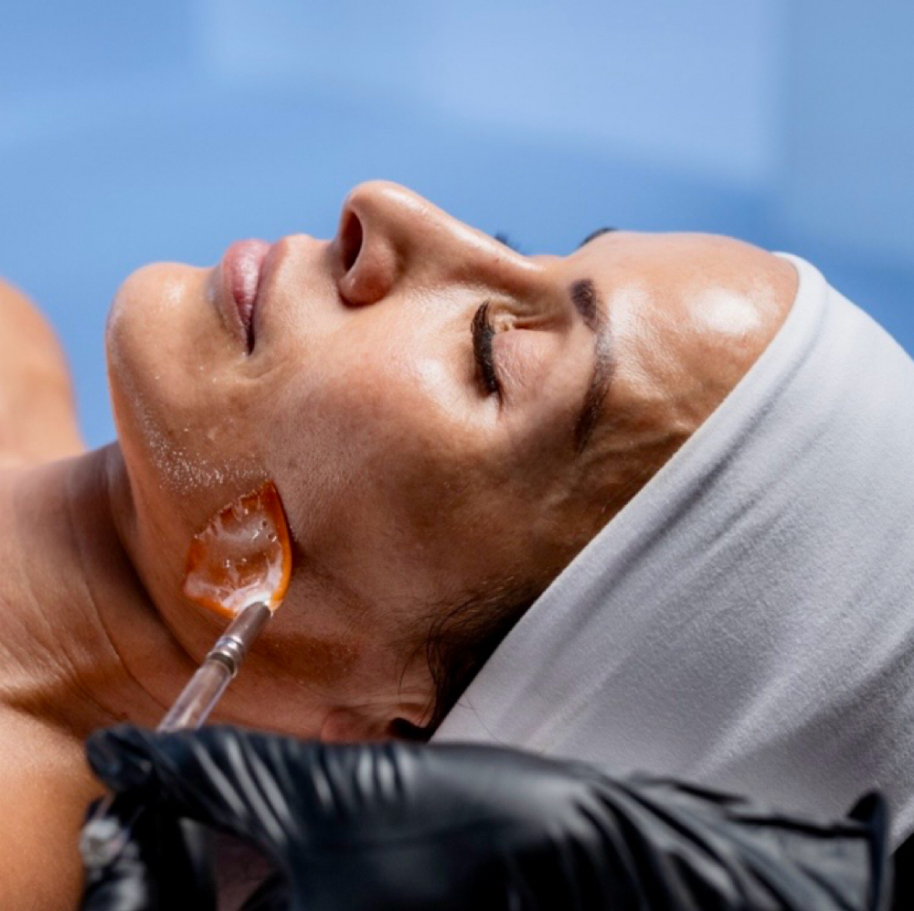 Customizeable Facial With Gel Peel at Go And Glow Esthetics in Merrick, NY