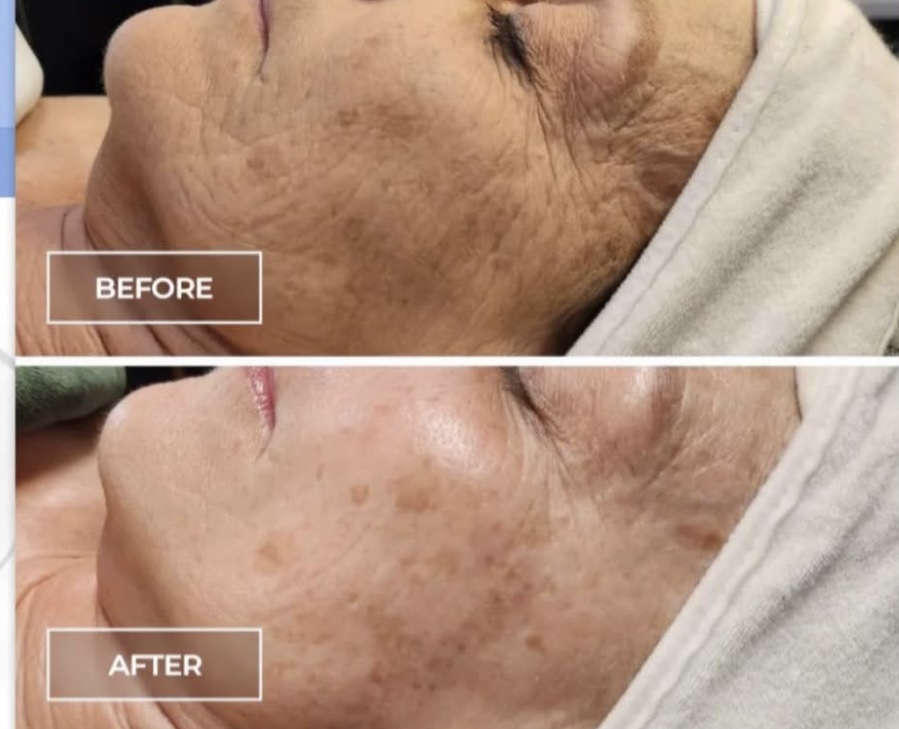 Switch Anti Aging System