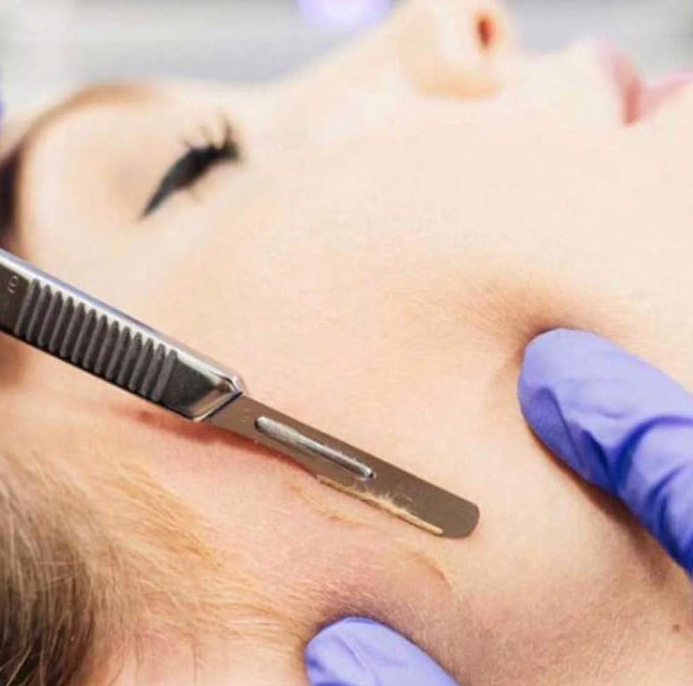 DERMAPLANE FACIAL