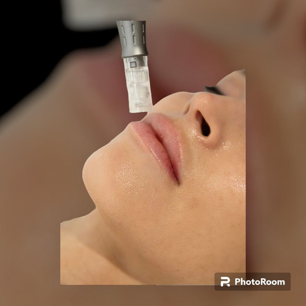 Nano Infusion