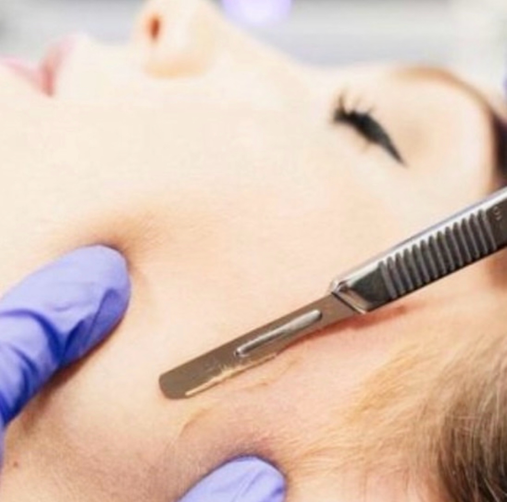 Dermaplane Treatment Facial