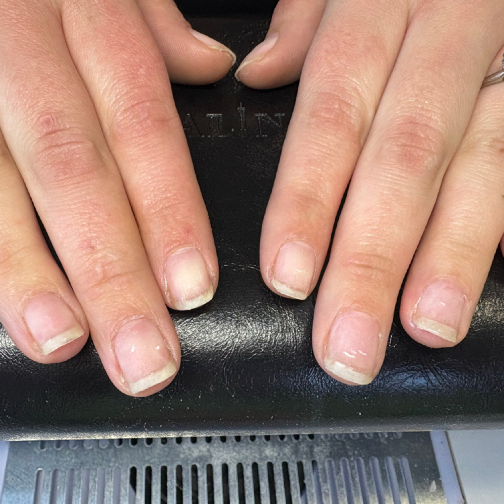Nail Removal at Chemically Dependent Salon in Redmond, OR