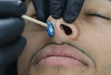 Nose