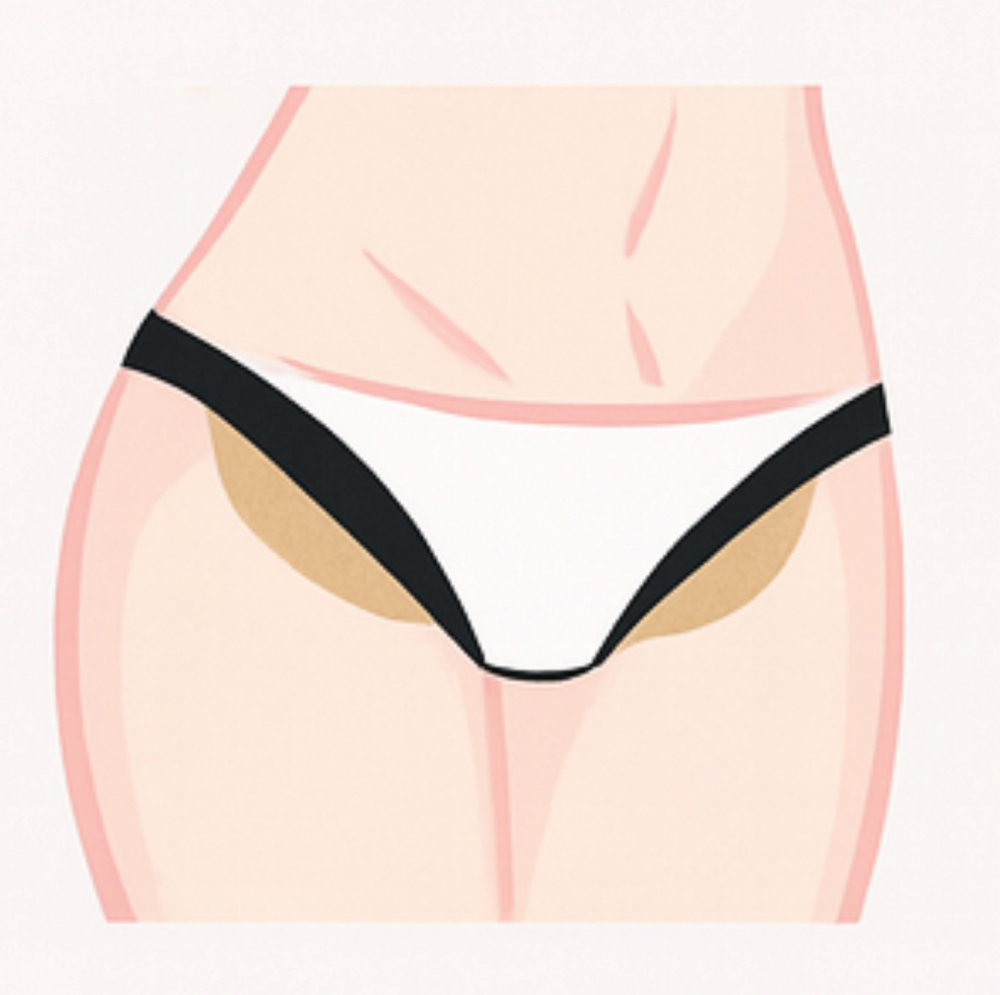 Bikini Line