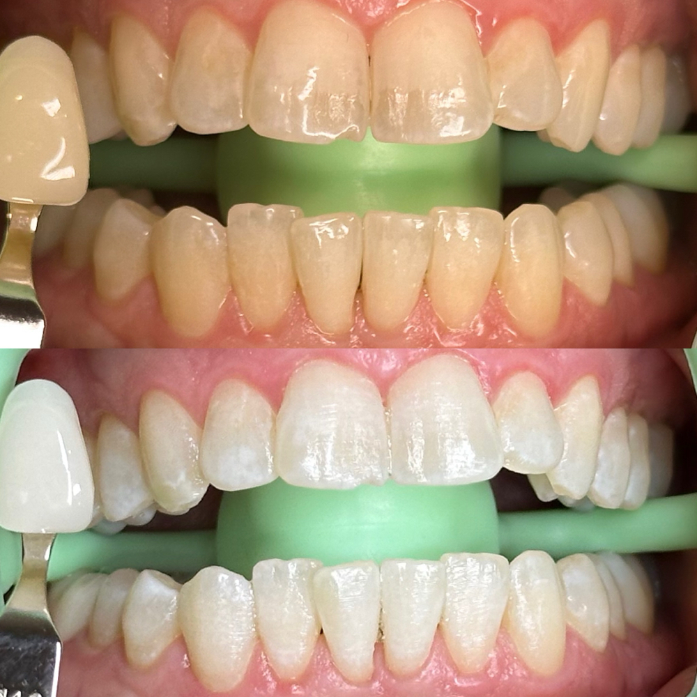 Hollywood Glow Session at Beauty Lab Los Angeles in Los Angeles, CA