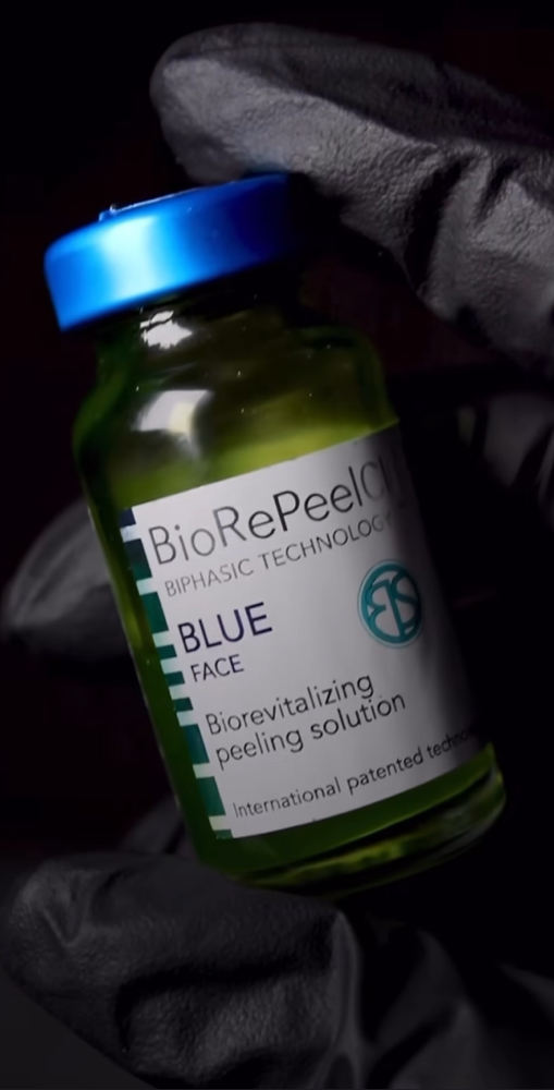 BioRePeel (No-Peel Chemical Peel)