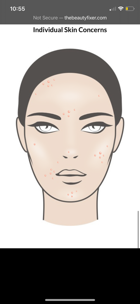 123 Acne Facial