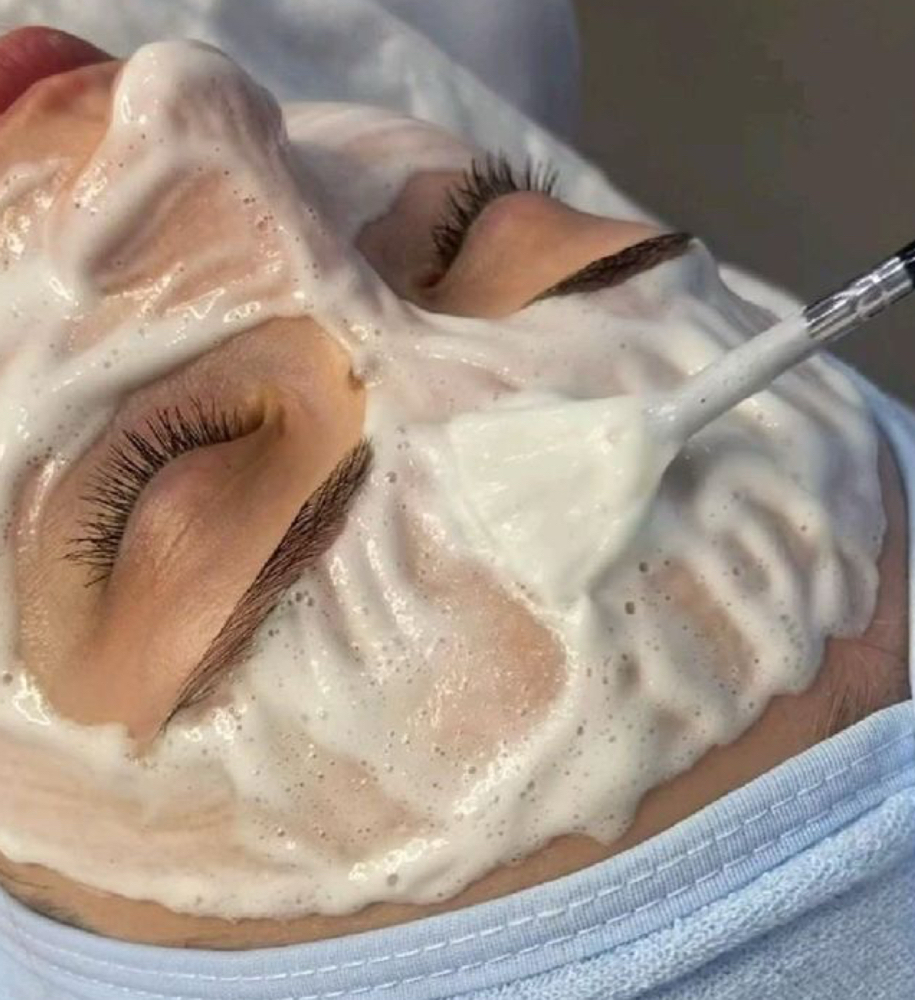 Microdermabrasion Facial at WinksEsthetics in Hamden, CT