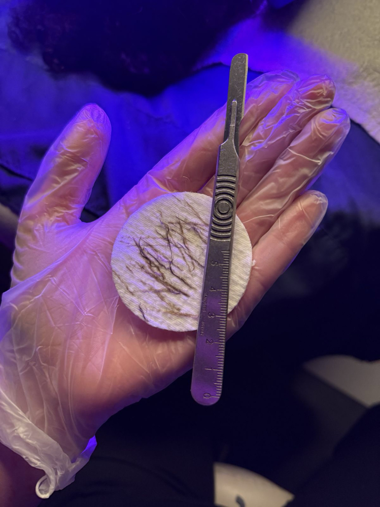 Dermaplaning Facial Promo at Dr. Beauty 360 by Estefany in Temecula, CA