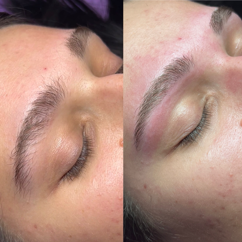 Lip/Chin/Brow at Raine Esthetics in Pendleton, IN