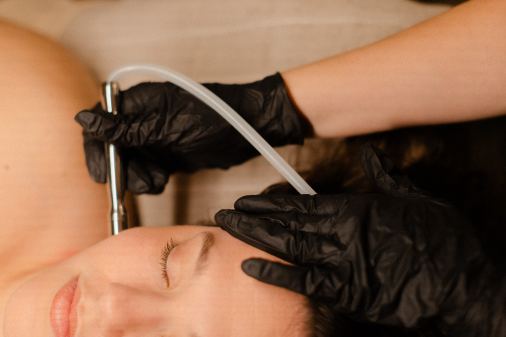 Microdermabrasion Facial at Sage & Skin Aesthetics in Somerset, KY