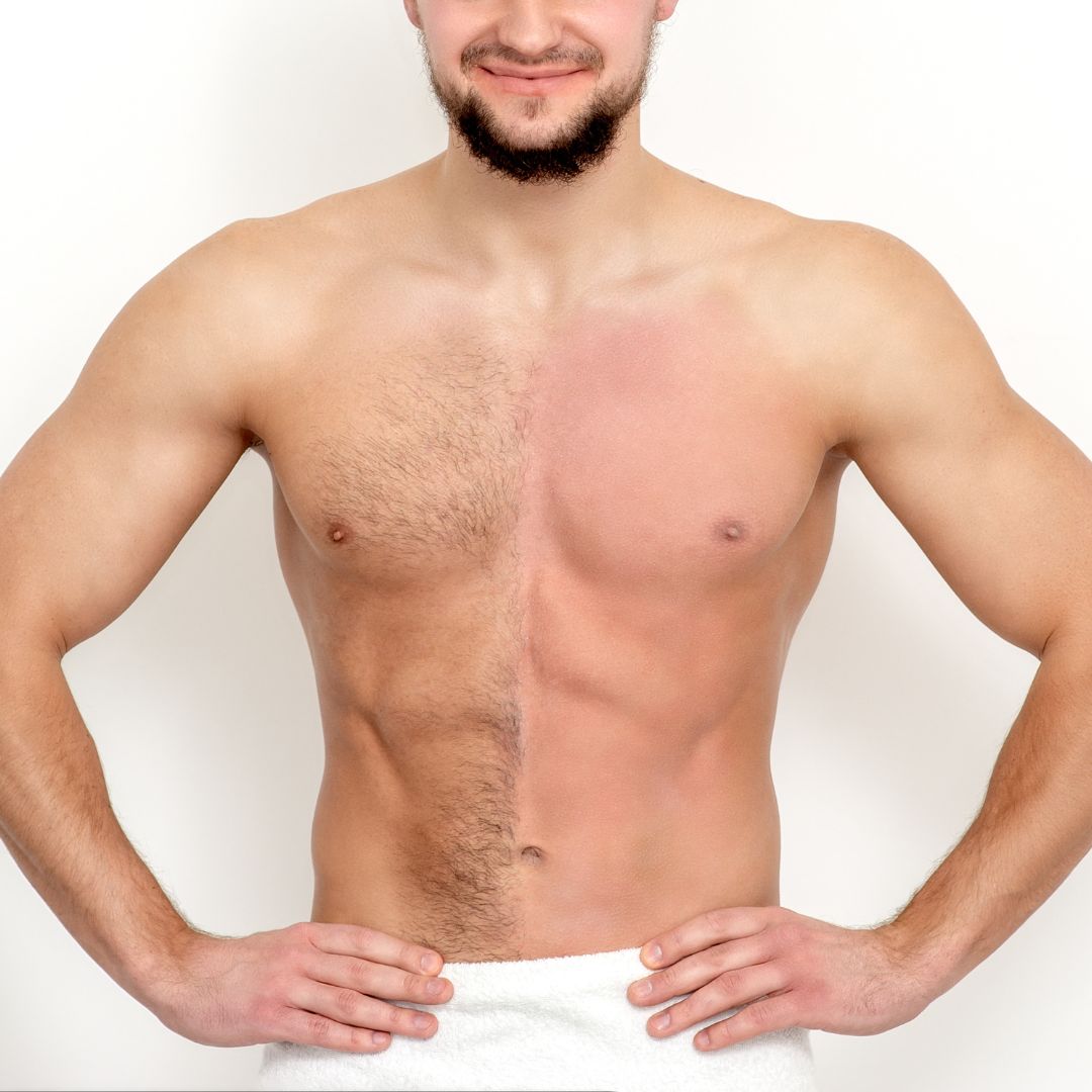 Men's Hair Removal