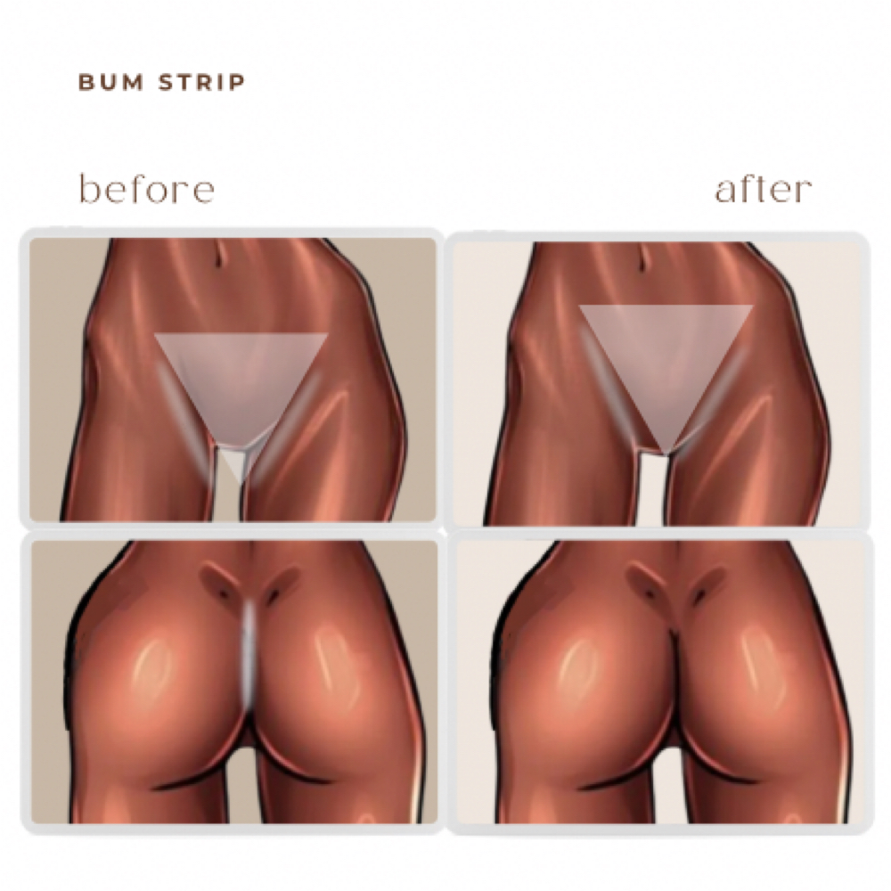 bum strip LASER HAIR REMOVAL at BEAUTY LAB COLLECTIVE in Miami, FL