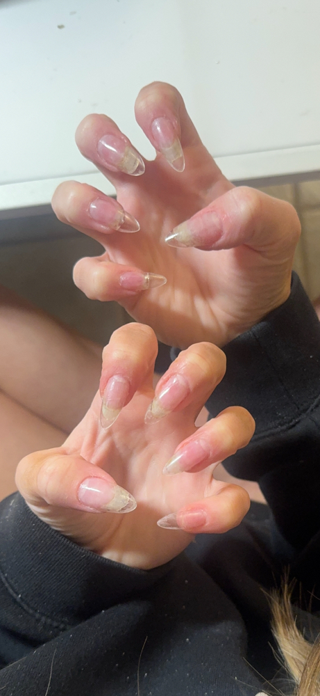 Nail Fix
