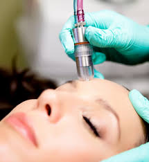 Microdermabrasion ADD-ON