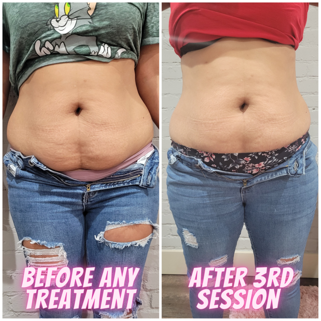 Stomach Snatcher 360 at Sleek Physique in Elgin, TX