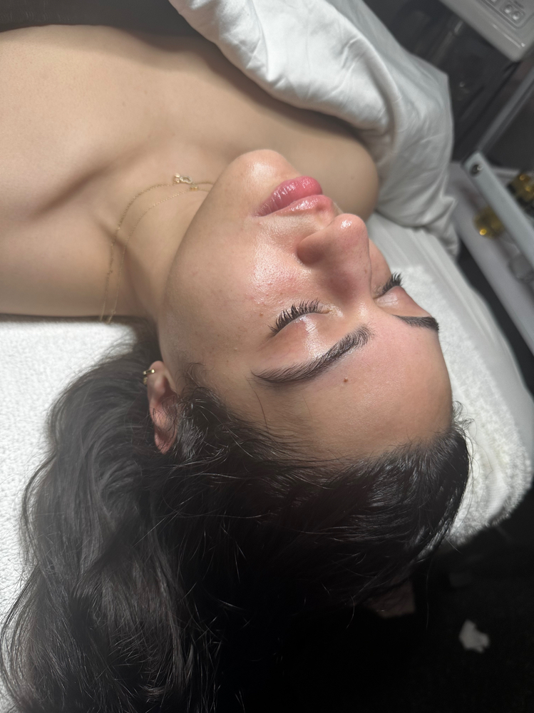 Oxygen Facial