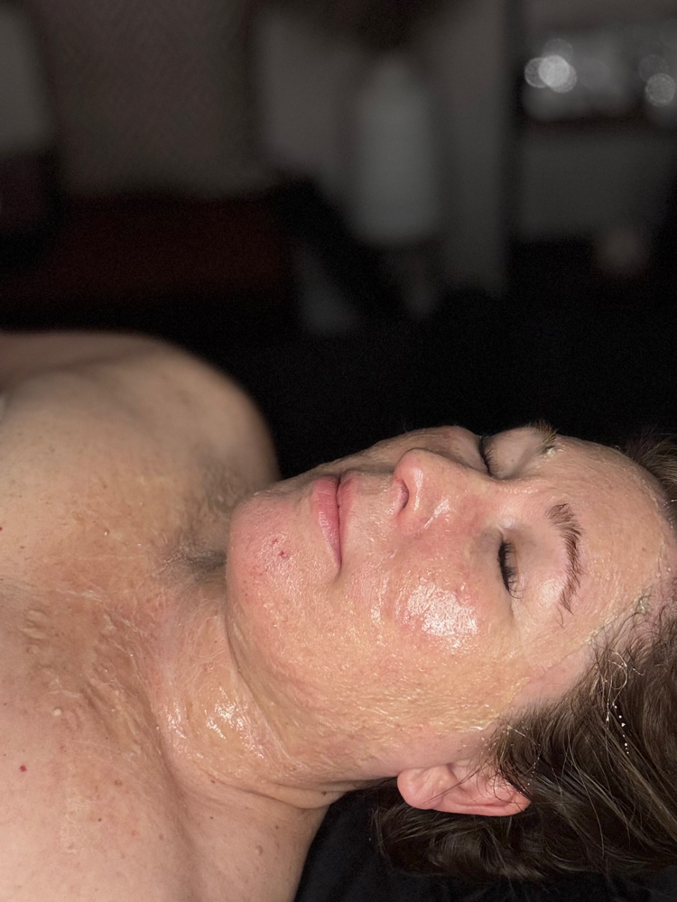 Luxe lift facial