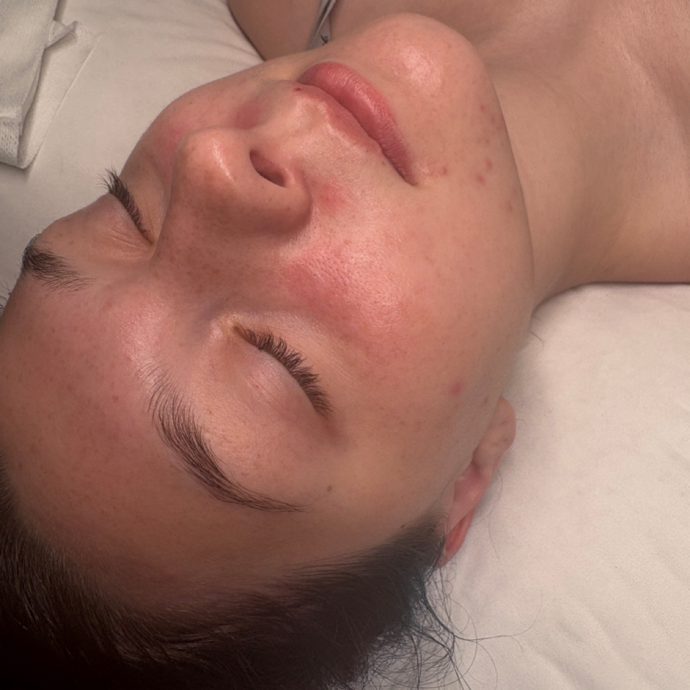 The Teen Facial at Aesthetics by Abby in Alliance, OH