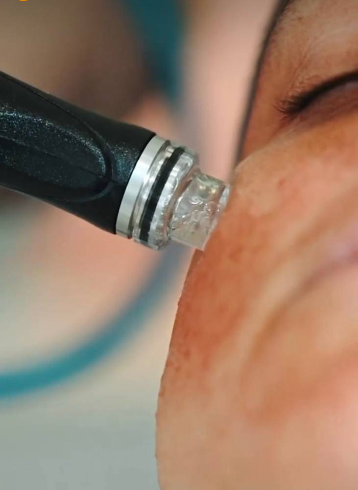 Signature Hydrafacial Package Of 3