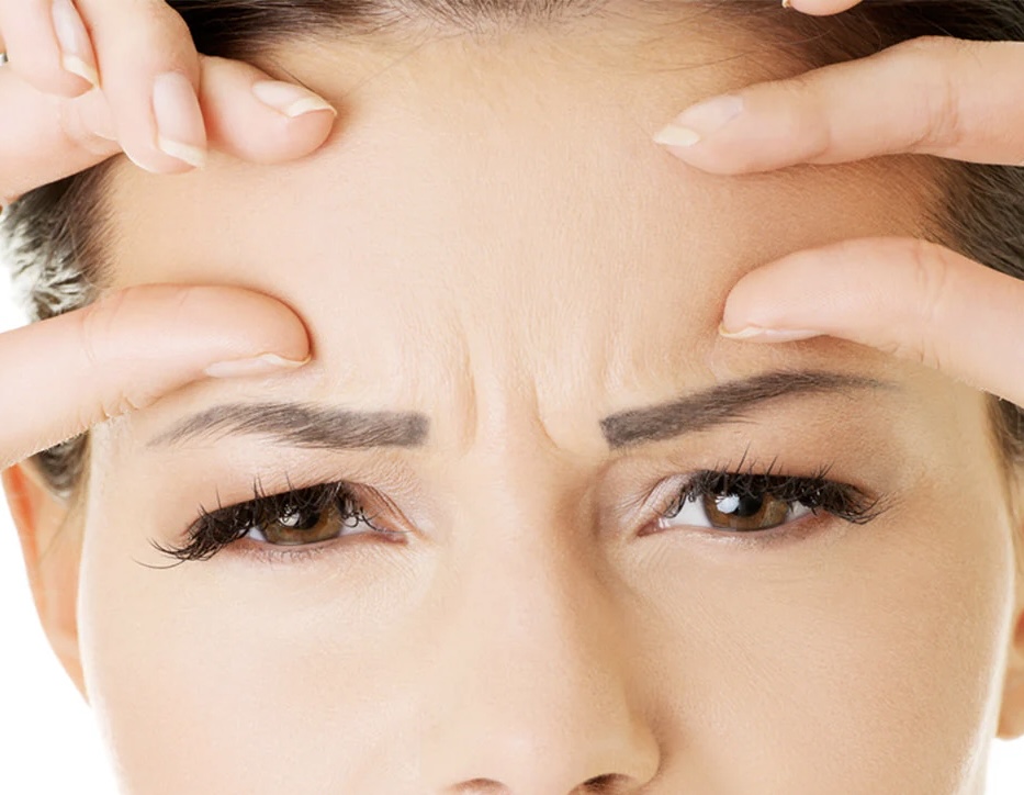 Botox – 20 Units
