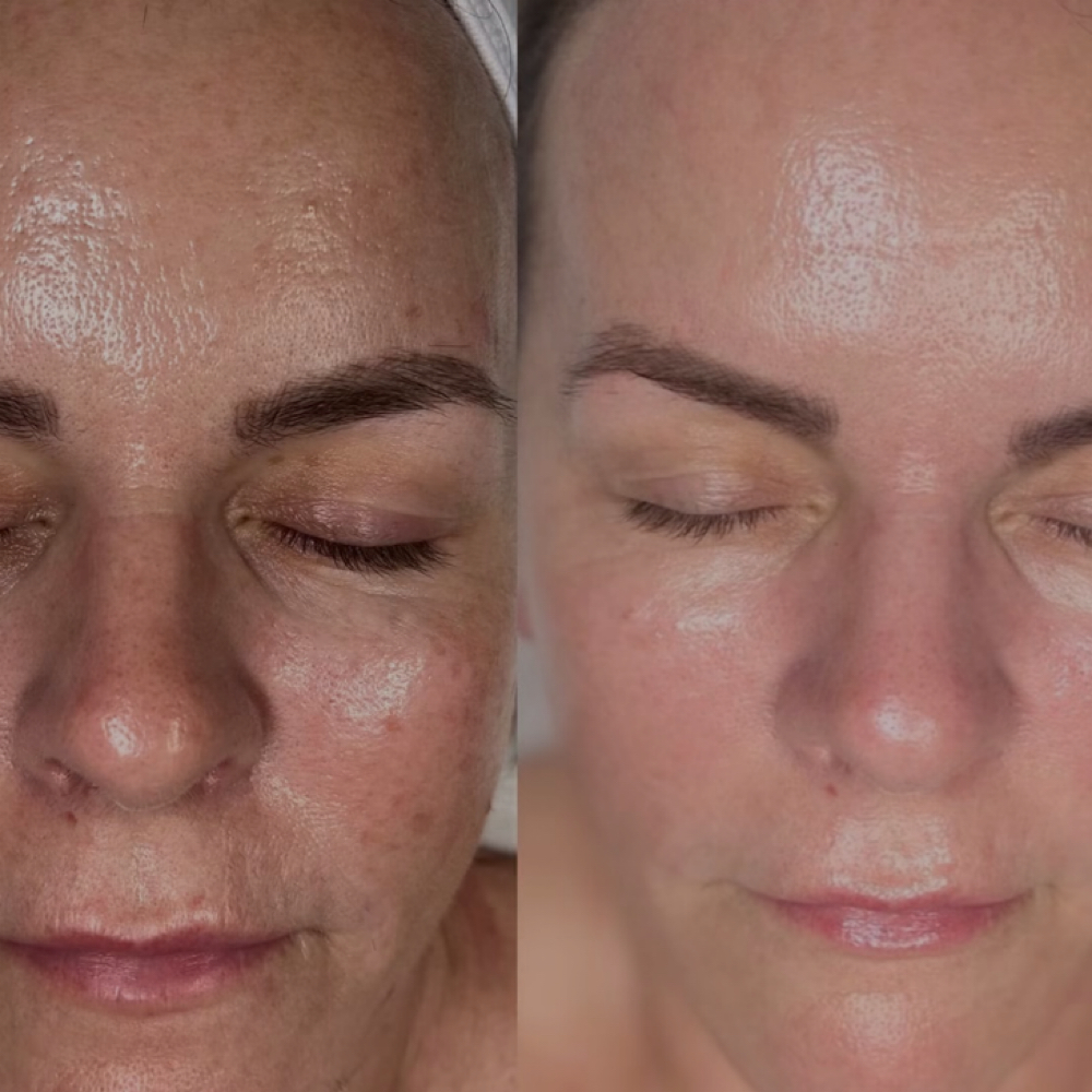 FOUNTAIN OF YOUTH at Eva Marie Esthetics in York, NE