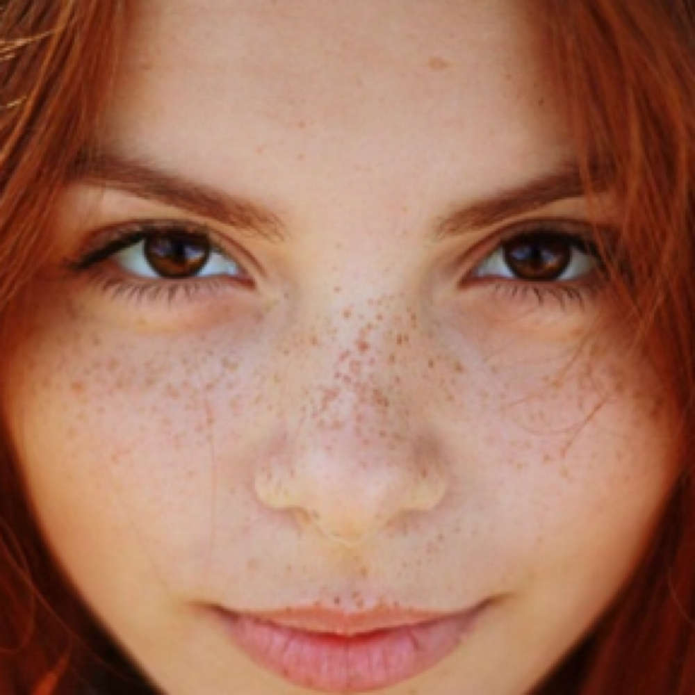 Faux Freckles Full Face at Platinum Beauty Esthetics in Rocklin, CA