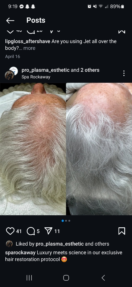 Hair Regenerative Skincare Service