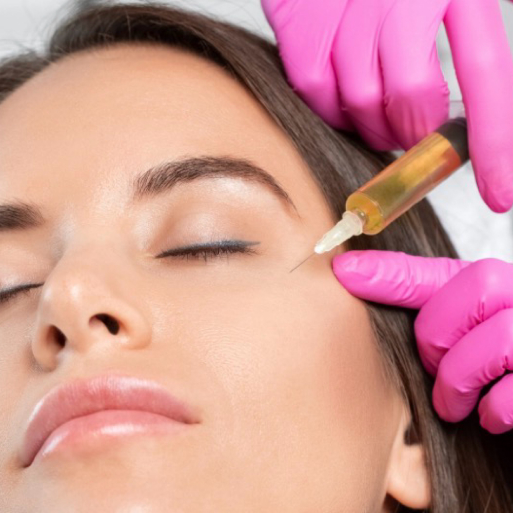 Antiaging treatment PRP at Ana Aesthetic & Beauty in Freeport, NY