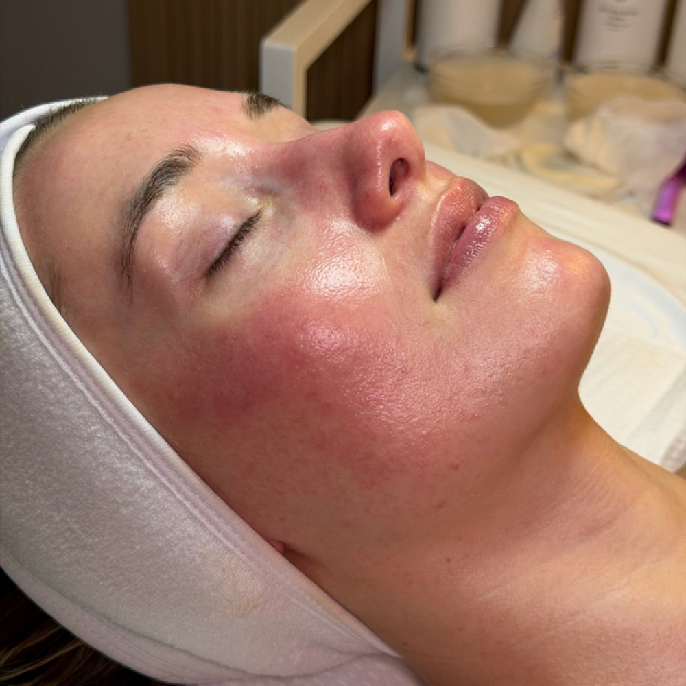 Custom Facial at Lumis MedSpa in Houston, TX