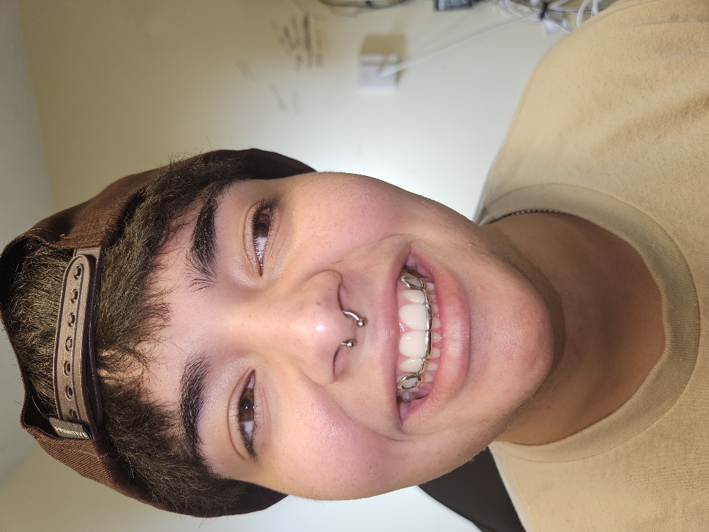 Silver Open Faces With Bar